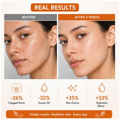 LA ROSE ETERNELLE 1% Salicylic Acid Face Wash with Soft Silicone, Deep Cleansing Face Cleanser for Oily & Acne-Prone Skin, Daily Use Face Wash, 100 ml