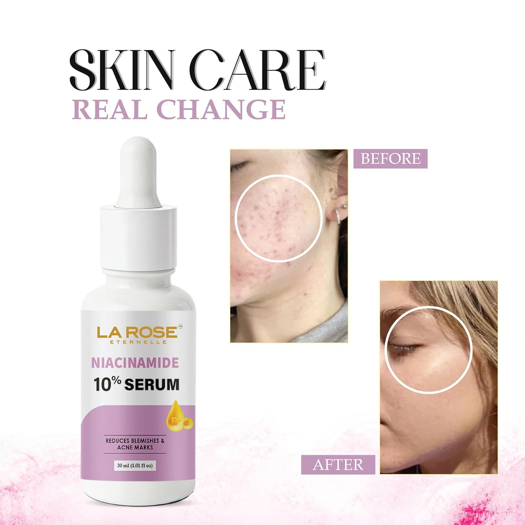 LA ROSE ETERNELLE Niacinamide 10% Serum, Reduces Blemishes and Acne Marks, 30 ml