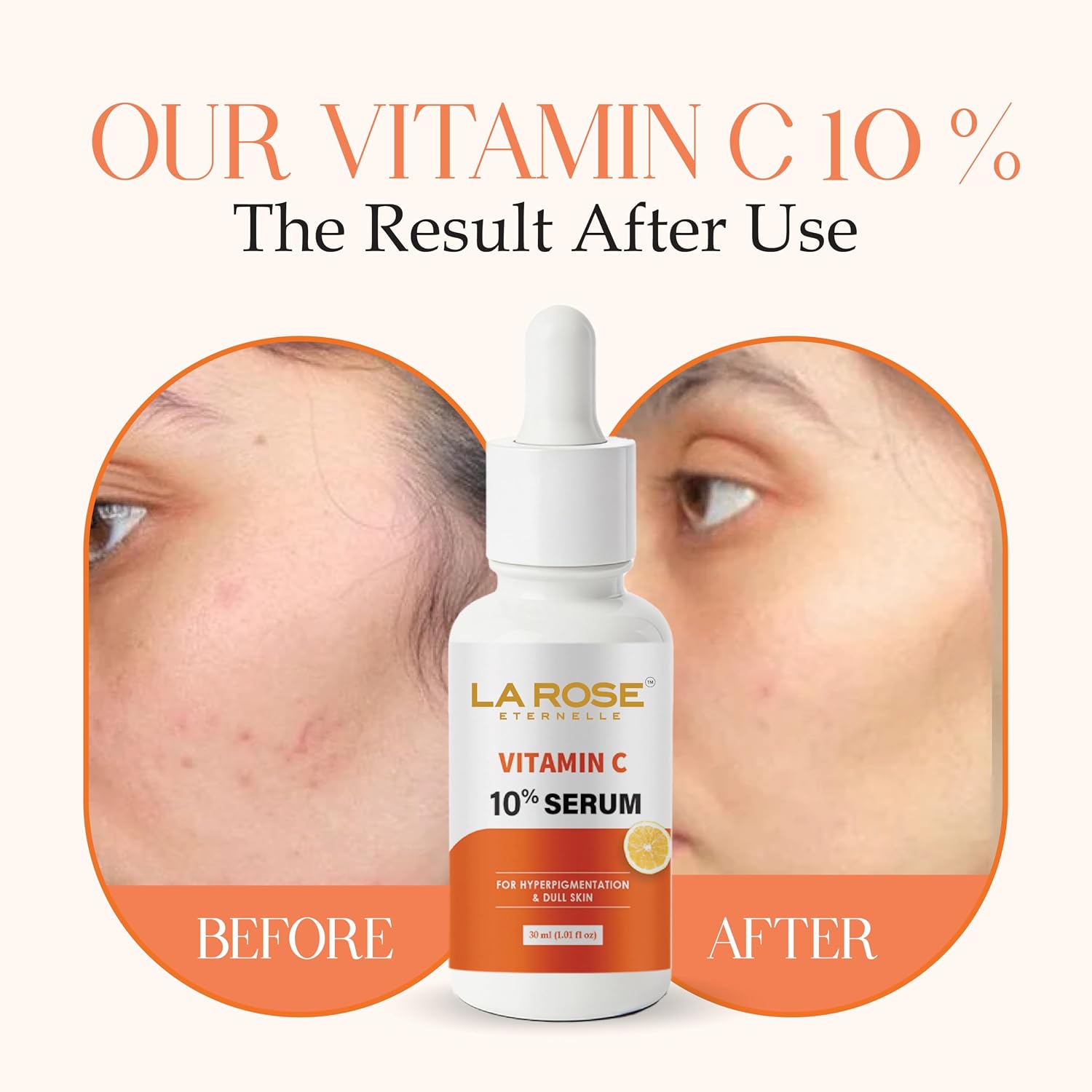 LA ROSE ETERNELLE Vitamin C 10% Serum for Hyperpigmentation and Dull Skin, 30ml