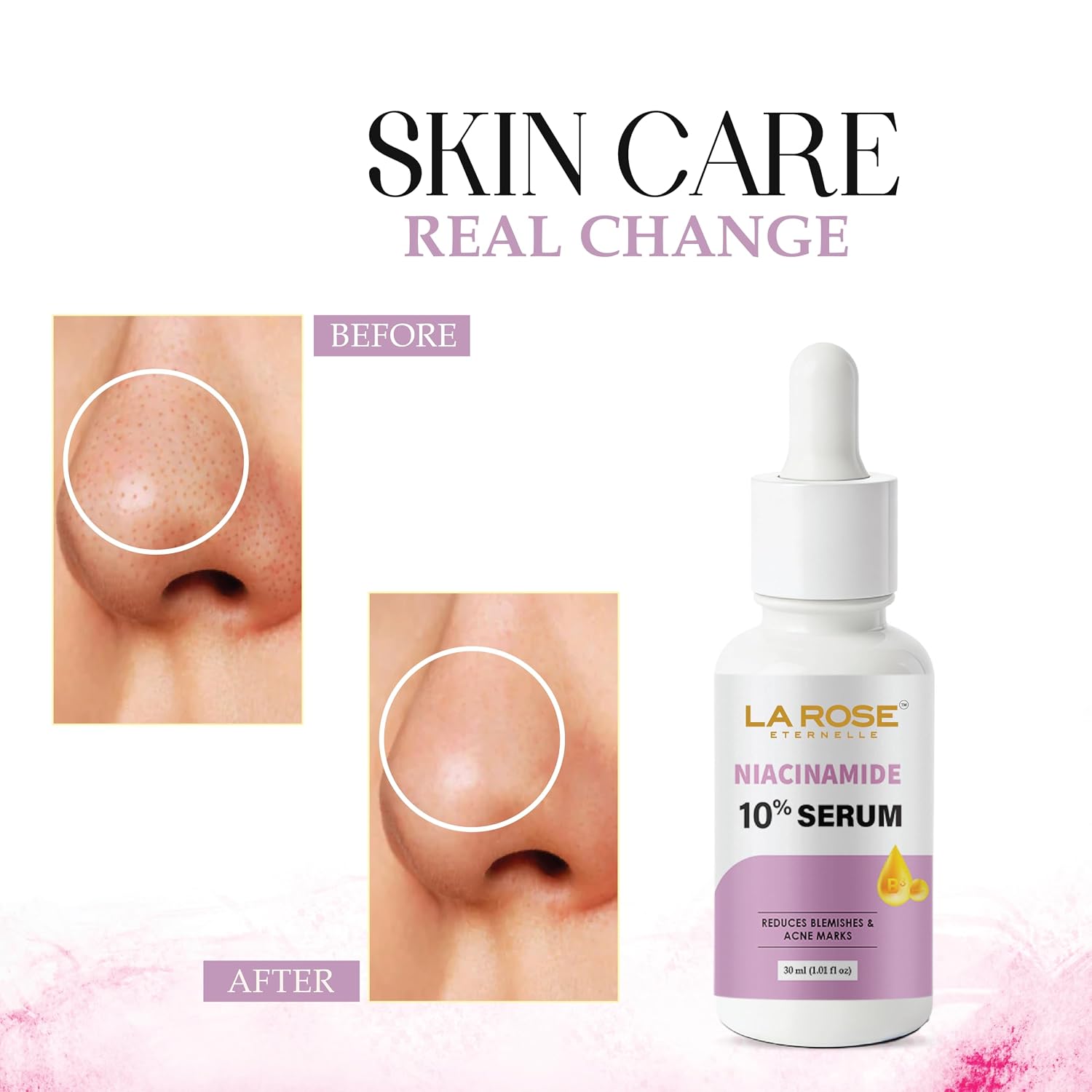 LA ROSE ETERNELLE Niacinamide 10% Serum, Reduces Blemishes and Acne Marks, 30 ml