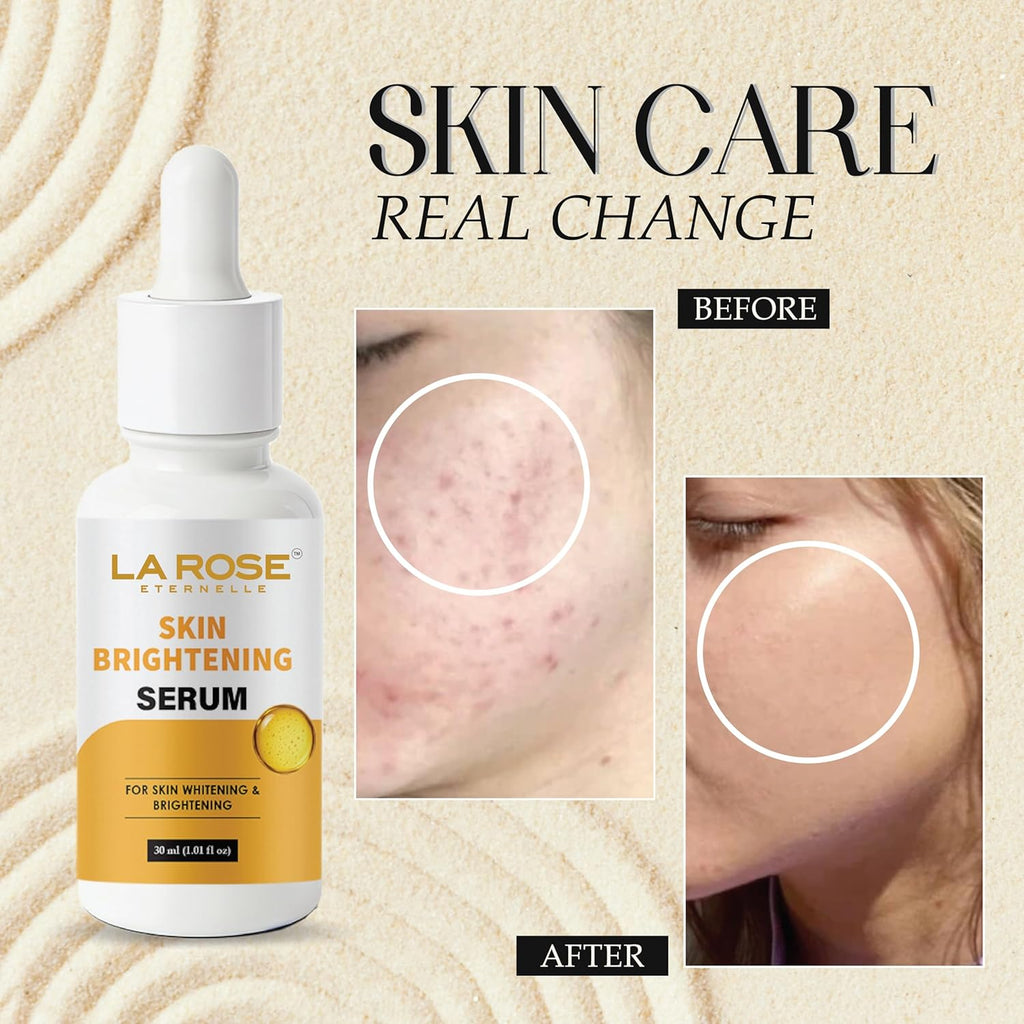 LA ROSE ETERNELLE Skin Brightening Face Serum, 30ml, with 10% Niacinamide for Blemish Control