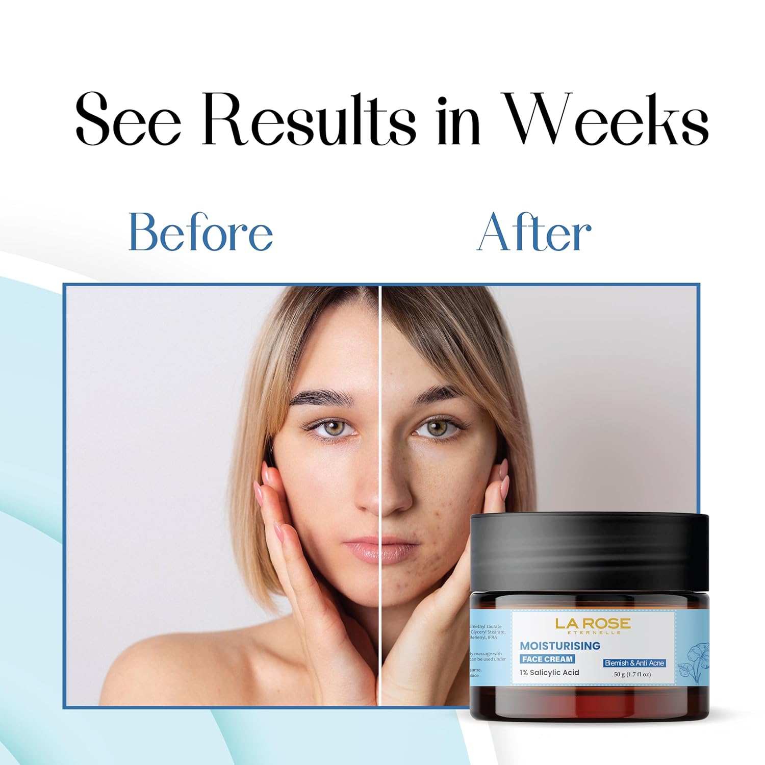 LA ROSE ETERNELLE Moisturising Face Cream with 1% Salicylic Acid Daily Facial Moisturizer for Men & Women Lightweight Hydrating Formula 50 g