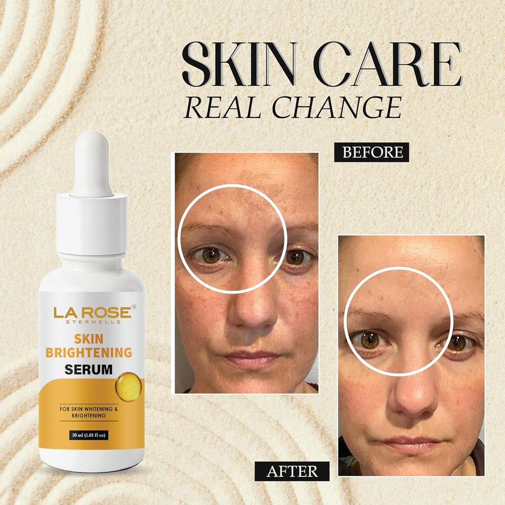 LA ROSE ETERNELLE Skin Brightening Face Serum, 30ml, with 10% Niacinamide for Blemish Control