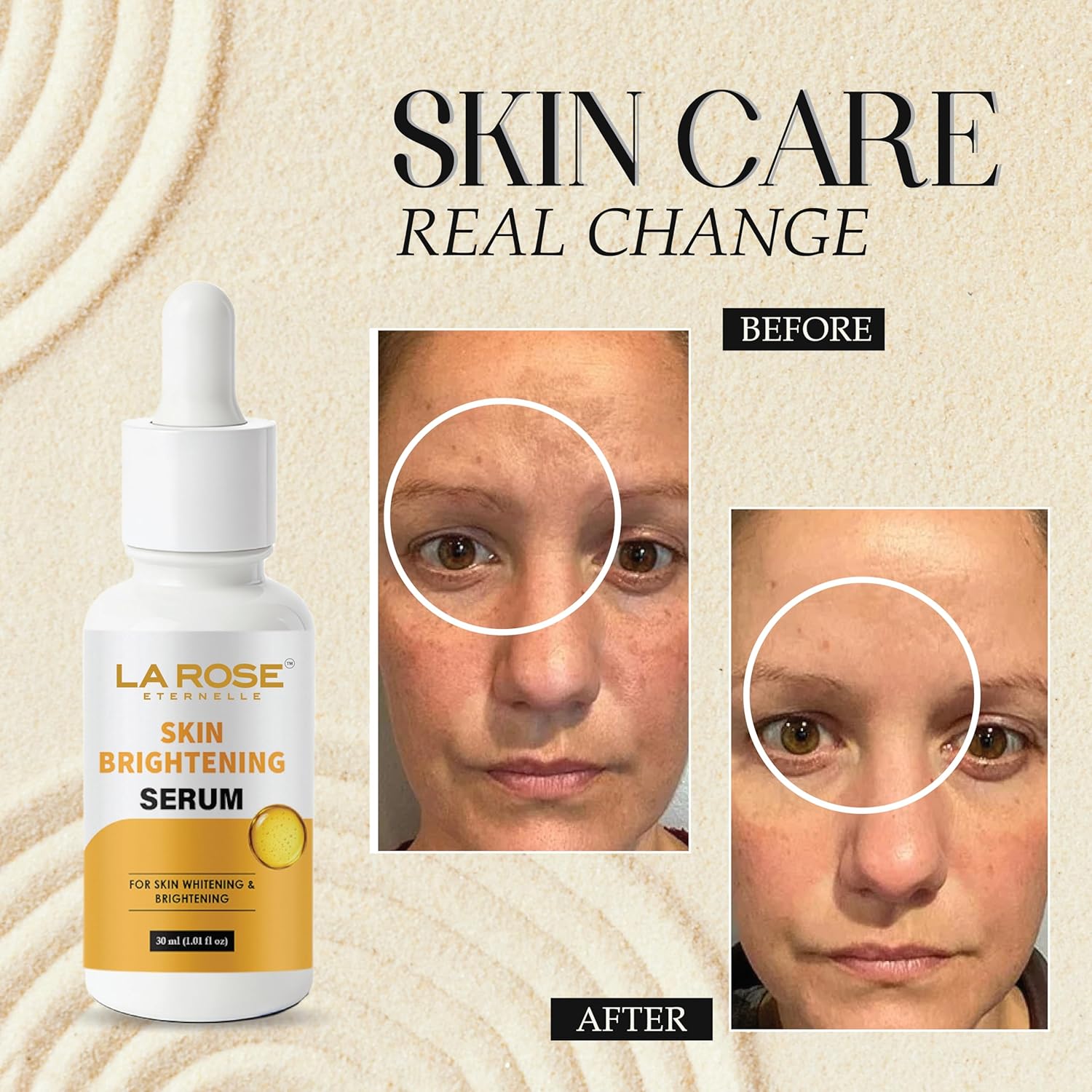 LA ROSE ETERNELLE Skin Brightening Face Serum, 30ml, with 10% Niacinamide for Blemish Control
